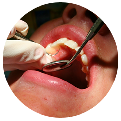 Patient's Oral Examination
